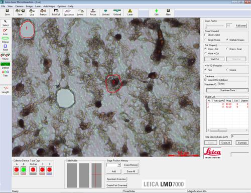 Phần mềm vi phẫu laser Leica LMD