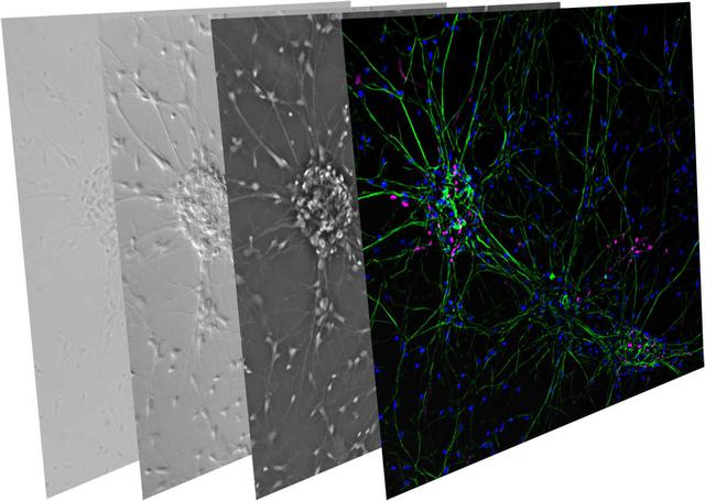 Hình ảnh minh họa một mẫu tế bào thần kinh