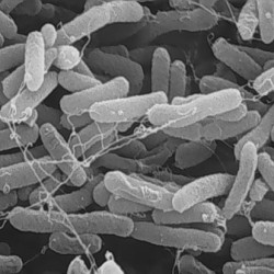 Vi khuẩn E. coli