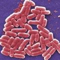Vi khuẩn E.coli O157:H7