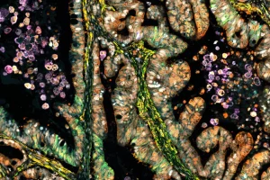 Giải pháp đa kênh linh hoạt Cell DIVE